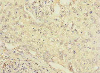 Immunohistochemistry (Formalin/PFA-fixed paraffin-embedded sections) - Anti-FCRL2 antibody (AB230318)