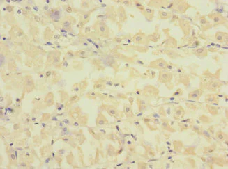 Immunohistochemistry (Formalin/PFA-fixed paraffin-embedded sections) - Anti-FCRL2 antibody (AB230318)