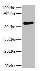 Western blot - Anti-FCRL2 antibody (AB230318)
