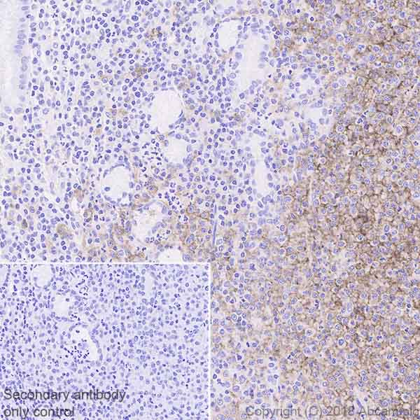 Immunohistochemistry (Formalin/PFA-fixed paraffin-embedded sections) - Anti-FCRL4 antibody [EPR21961] (AB239076)