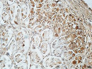 Immunohistochemistry (Formalin/PFA-fixed paraffin-embedded sections) - Anti-FCRL5 antibody (AB177204)