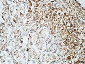 Immunohistochemistry (Formalin/PFA-fixed paraffin-embedded sections) - Anti-FCRL5 antibody (AB177204)