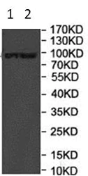 Western blot - Anti-FCRL5 antibody (AB177204)