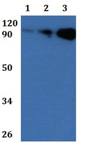 Western blot - Anti-FCRL5 antibody (AB201105)