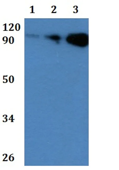 Western blot - Anti-FCRL5 antibody (AB201105)