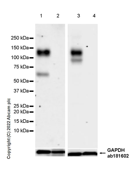 Western blot - Anti-FCRL5 antibody [EPR27365-87] - BSA and Azide free (AB307731)
