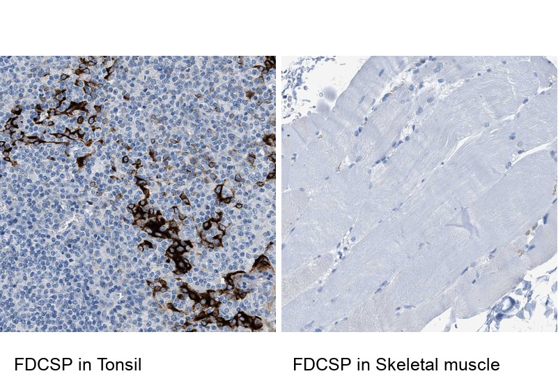 Immunohistochemistry (Formalin/PFA-fixed paraffin-embedded sections) - Anti-FDCSP antibody (AB121420), expandable thumbnail
