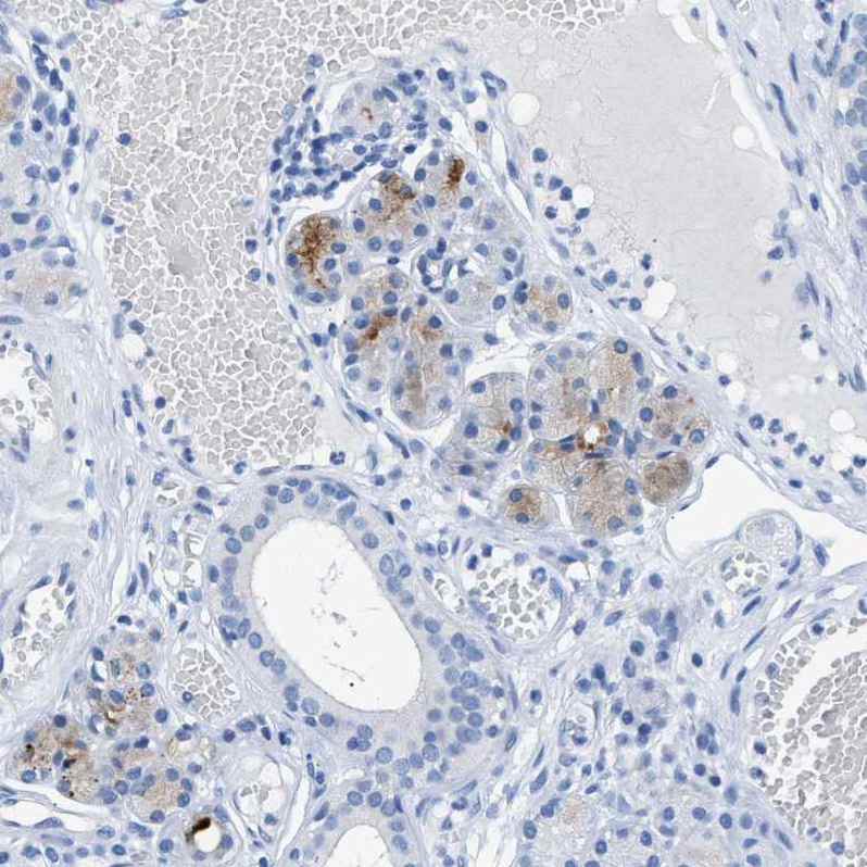 Immunohistochemistry (Formalin/PFA-fixed paraffin-embedded sections) - Anti-FDCSP antibody (AB121420), expandable thumbnail