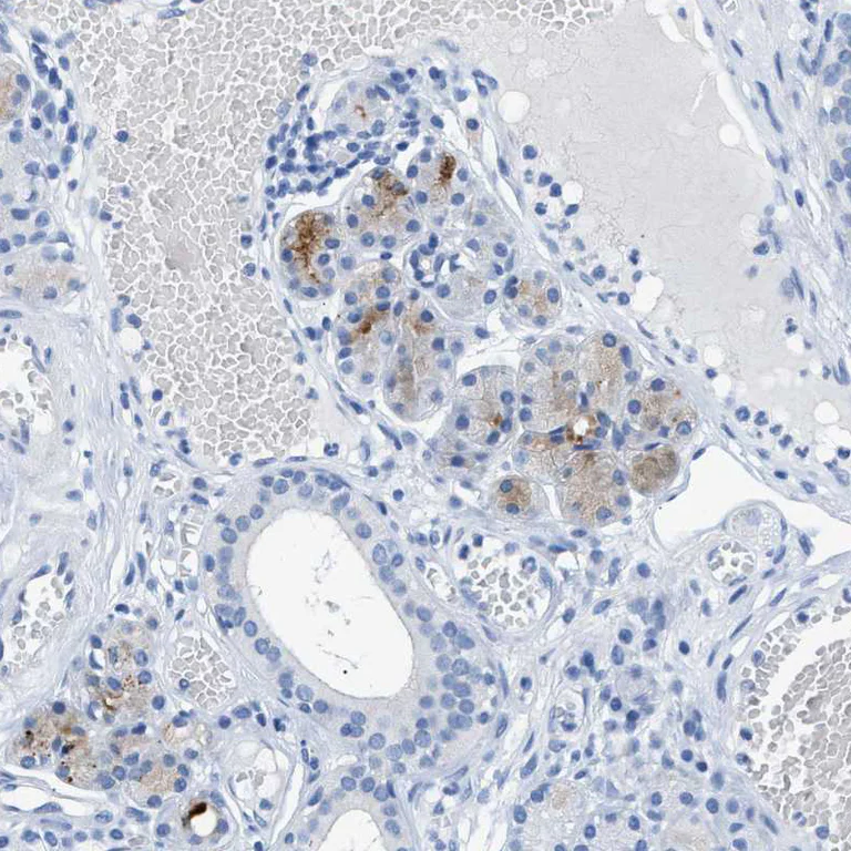 Immunohistochemistry (Formalin/PFA-fixed paraffin-embedded sections) - Anti-FDCSP antibody (AB121420)