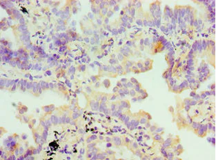 Immunohistochemistry (Formalin/PFA-fixed paraffin-embedded sections) - Anti-FDFT1 antibody (AB236666)