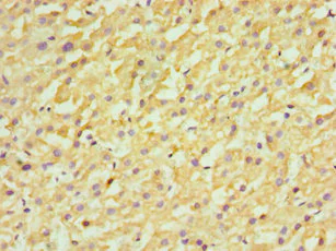 Immunohistochemistry (Formalin/PFA-fixed paraffin-embedded sections) - Anti-FDFT1 antibody (AB236666)