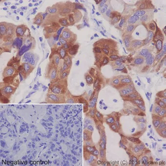 Immunohistochemistry (Formalin/PFA-fixed paraffin-embedded sections) - Anti-FDFT1 antibody [EPR16481] (AB195046)