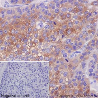 Immunohistochemistry (Formalin/PFA-fixed paraffin-embedded sections) - Anti-FDFT1 antibody [EPR16481] (AB195046)