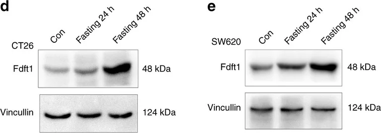 Western blot - Anti-FDFT1 antibody [EPR16481] (AB195046)
