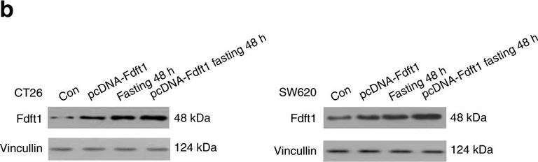 Western blot - Anti-FDFT1 antibody [EPR16481] (AB195046)