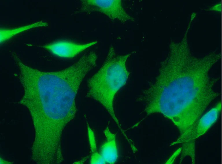 Immunocytochemistry - Anti-FDPS/FPS antibody [005] (AB277132)