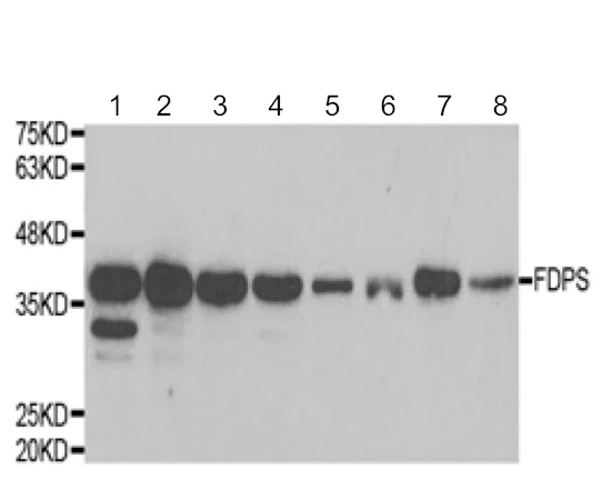Western blot - Anti-FDPS/FPS antibody - C-terminal (AB189874)