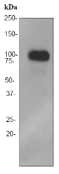 Western blot - Anti-FE65 antibody [EPR3538] (AB91650), expandable thumbnail