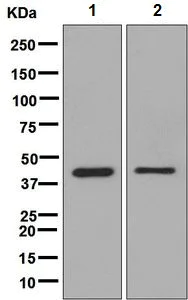 Western blot - Anti-FECH antibody [EPR8312] (AB137042)