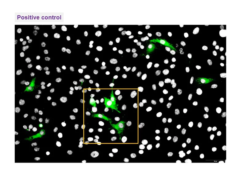Immunocytochemistry/ Immunofluorescence - Anti-FeLV antibody [CM1] (AB325985)