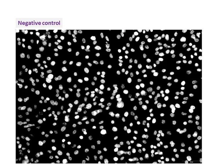 Immunocytochemistry/ Immunofluorescence - Anti-FeLV antibody [CM1] (AB325985)