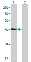 Western blot - Anti-FEM1A antibody (AB103421)