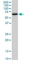 Western blot - Anti-FEM1A antibody (AB103421)