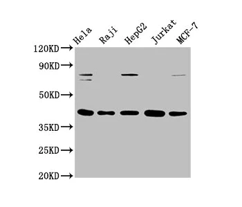 Western blot - Anti-FEN1 antibody [4D9] (AB314001)