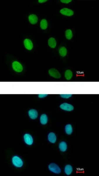 Immunocytochemistry/ Immunofluorescence - Anti-FEN1 antibody (AB153825)