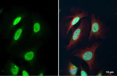 Immunocytochemistry/ Immunofluorescence - Anti-FEN1 antibody (AB153825)