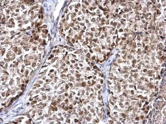Immunohistochemistry (Formalin/PFA-fixed paraffin-embedded sections) - Anti-FEN1 antibody (AB153825)