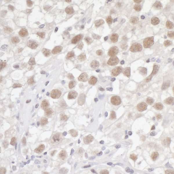 Immunohistochemistry (Formalin/PFA-fixed paraffin-embedded sections) - Anti-FEN1 antibody (AB17994)