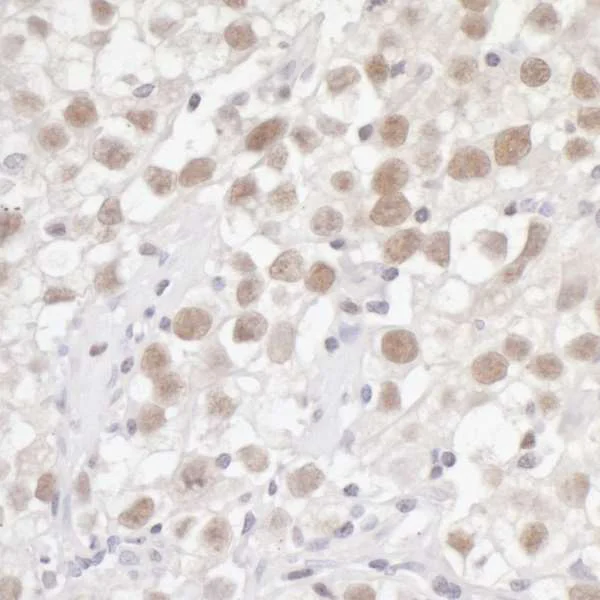 Immunohistochemistry (Formalin/PFA-fixed paraffin-embedded sections) - Anti-FEN1 antibody (AB17994)