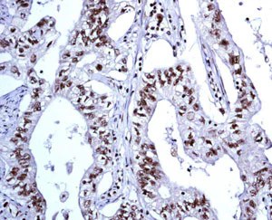 Immunohistochemistry (Formalin/PFA-fixed paraffin-embedded sections) - Anti-FEN1 antibody [EPR4459(2)] (AB133311)