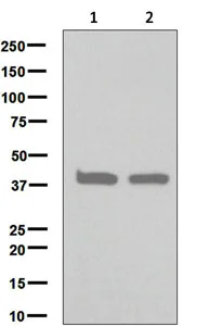 Western blot - Anti-FEN1 antibody [EPR4459(2)] (AB133311)