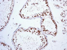 Immunohistochemistry (Formalin/PFA-fixed paraffin-embedded sections) - Anti-FEN1 antibody [EPR4460(2)] - BSA and Azide free (AB239948)