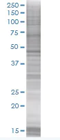 SDS-PAGE - FEN1 overexpression 293T lysate (whole cell) (AB94222)