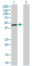 Western blot - FEN1 overexpression 293T lysate (whole cell) (AB94222), expandable thumbnail