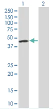 Western blot - FEN1 overexpression 293T lysate (whole cell) (AB94222)