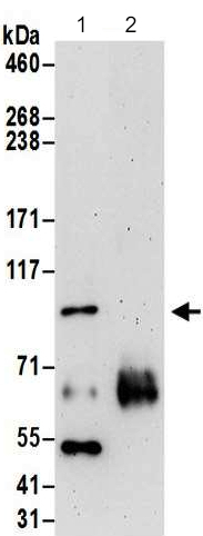 Immunoprecipitation - Anti-FER antibody (AB187685)