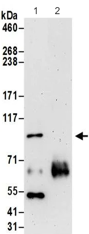 Immunoprecipitation - Anti-FER antibody (AB187685)