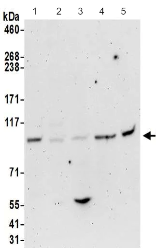 Western blot - Anti-FER antibody (AB187685)