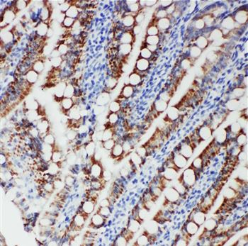 Immunohistochemistry (Formalin/PFA-fixed paraffin-embedded sections) - Anti-FER antibody (AB191060)