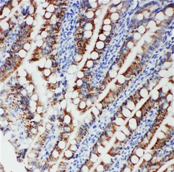 Immunohistochemistry (Formalin/PFA-fixed paraffin-embedded sections) - Anti-FER antibody (AB191060)