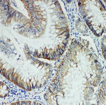 Immunohistochemistry (Formalin/PFA-fixed paraffin-embedded sections) - Anti-FER antibody (AB191060)