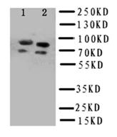 Western blot - Anti-FER antibody (AB191060)