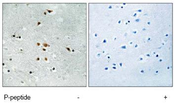 Immunohistochemistry (Formalin/PFA-fixed paraffin-embedded sections) - Anti-FER (phospho Y402) antibody (AB79573)