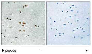 Immunohistochemistry (Formalin/PFA-fixed paraffin-embedded sections) - Anti-FER (phospho Y402) antibody (AB79573)