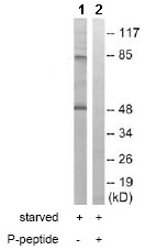 Western blot - Anti-FER (phospho Y402) antibody (AB79573)