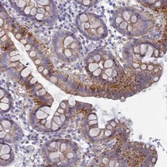 Immunohistochemistry (Formalin/PFA-fixed paraffin-embedded sections) - Anti-FERDL3 antibody (AB126381)
